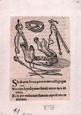 A detailed black-and-white illustration of dental tools and a human jawbone, likely from a historical medical or dental text. The drawing includes forceps, a coil of wire, and other instruments arranged around the jawbone, accompanied by Latin text describing their use or procedure.